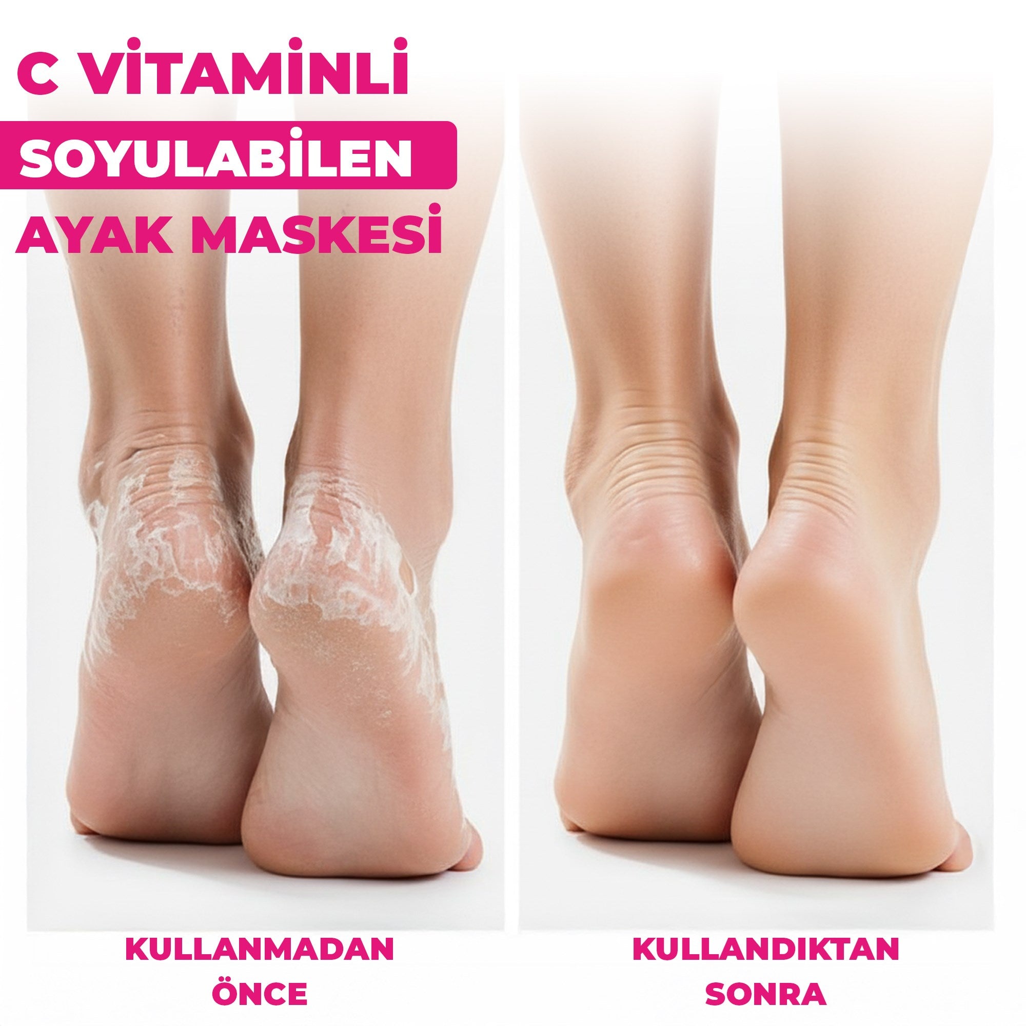 C Vitaminli Peeling Etkili Soyulabilen Çorap Tipi Ayak Maskesi 30 ml