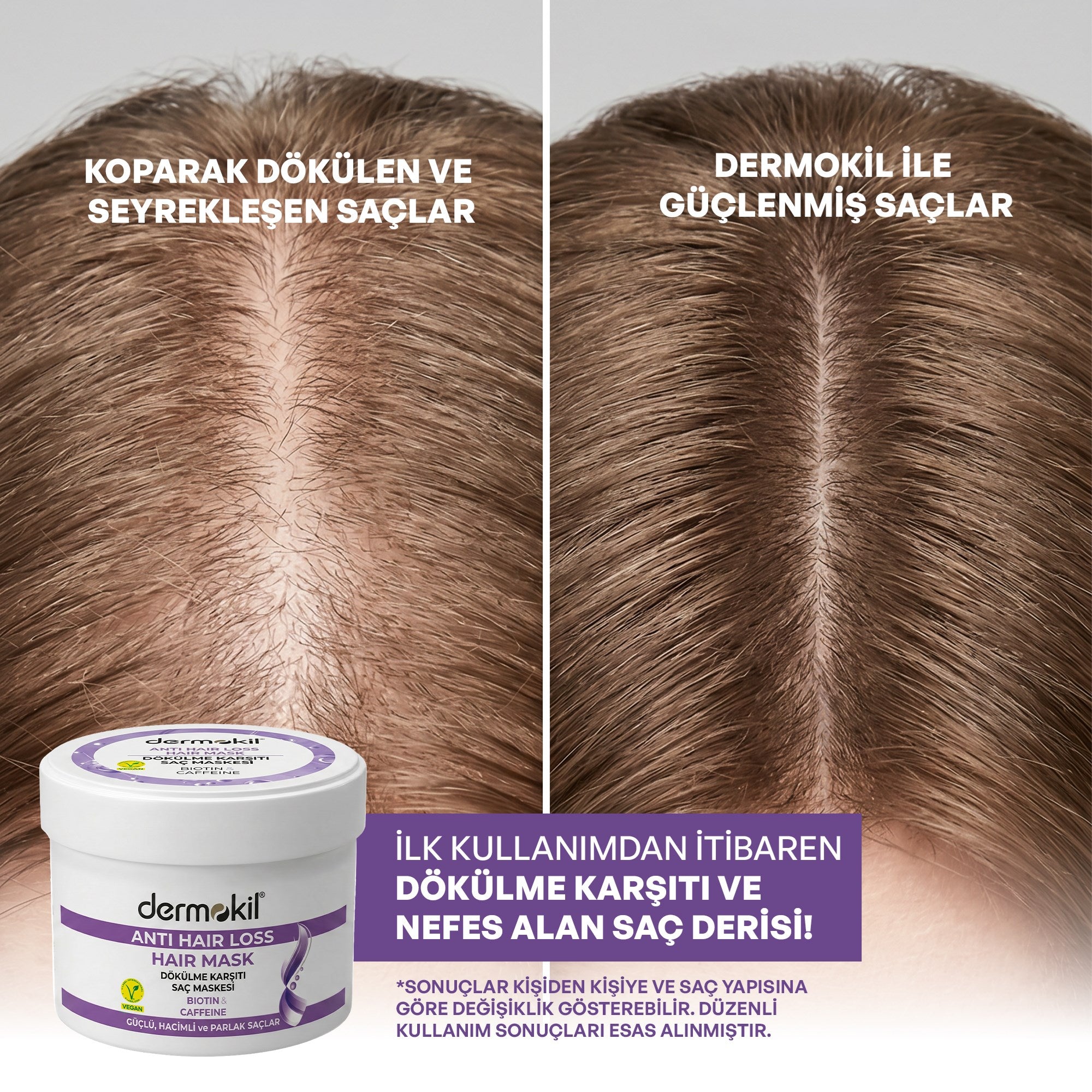 Dökülme Karşıtı (Biotine-Caffeine) Saç Bakım Maskesi 250 ml - Dermokil