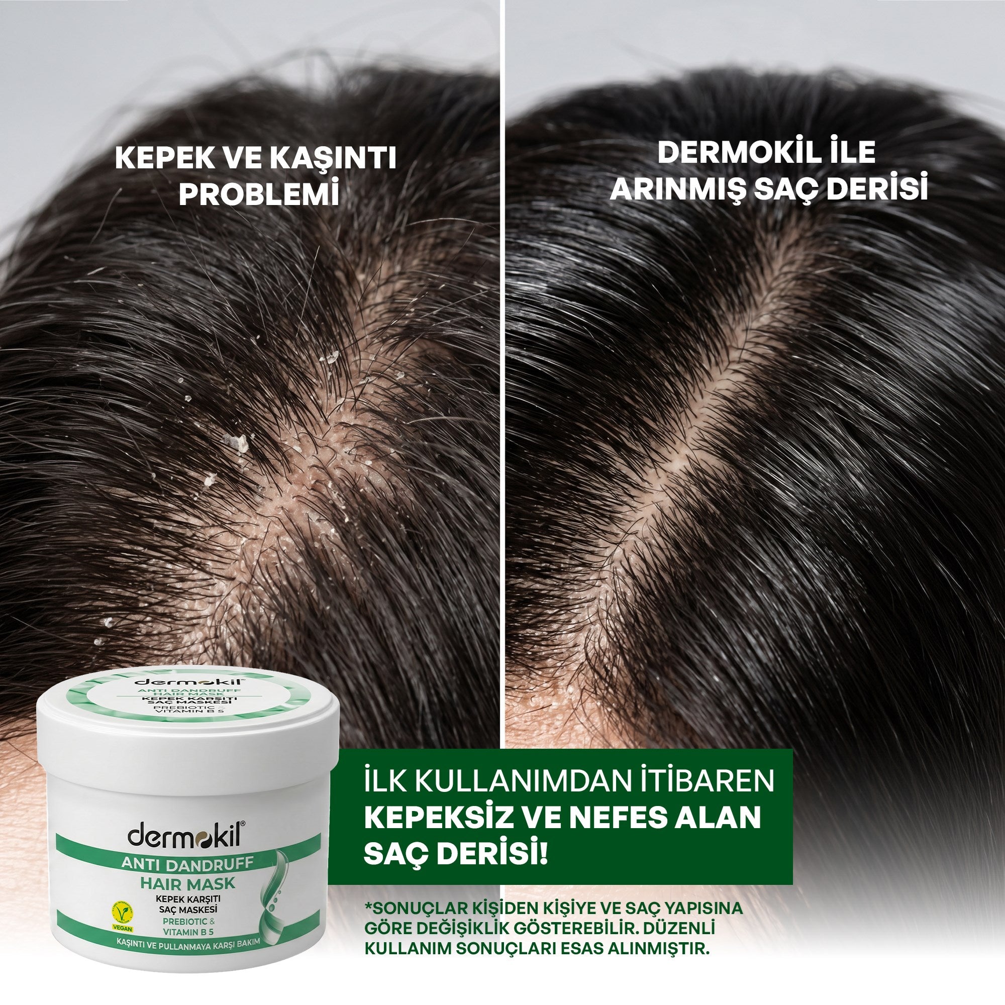 Kepeğe Karşı Prebiotic & Vitamin B5 Saç Bakım Maskesi 250 ml - Dermokil