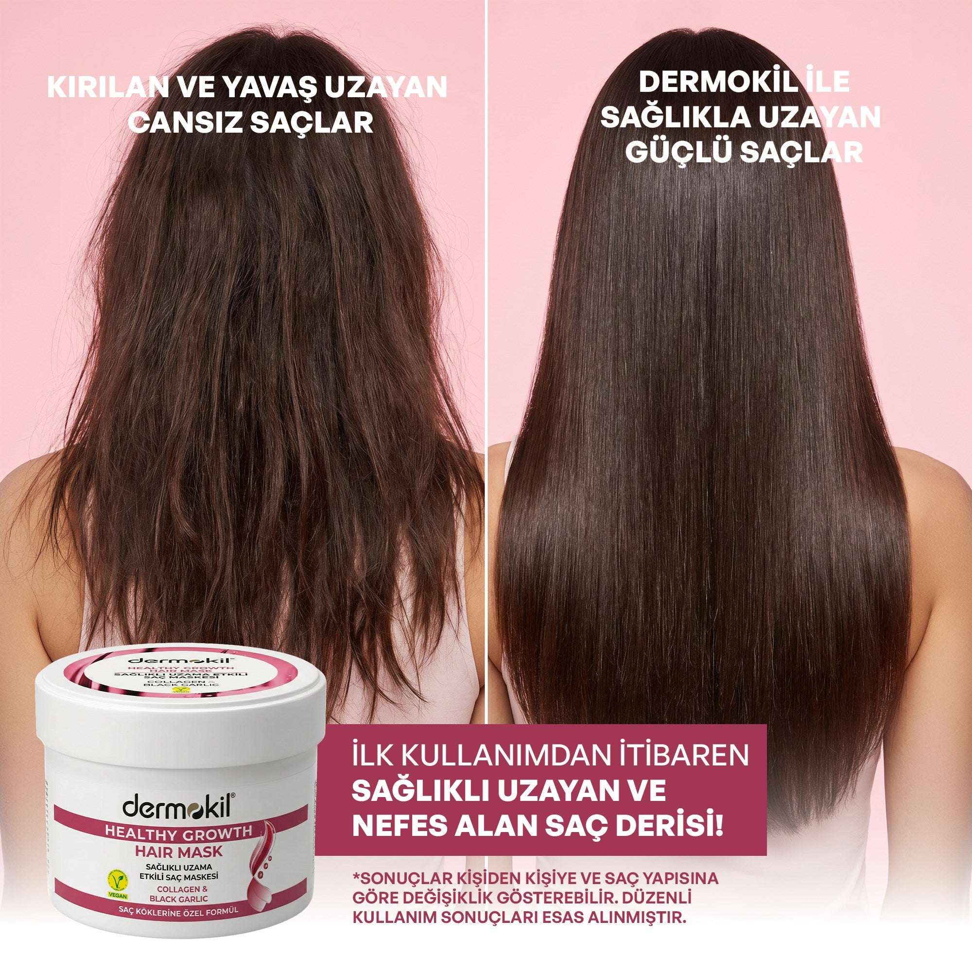 Güçlendirici Kolajen & Siyah Sarımsak Saç Bakım Maskesi 250 ml - Dermokil