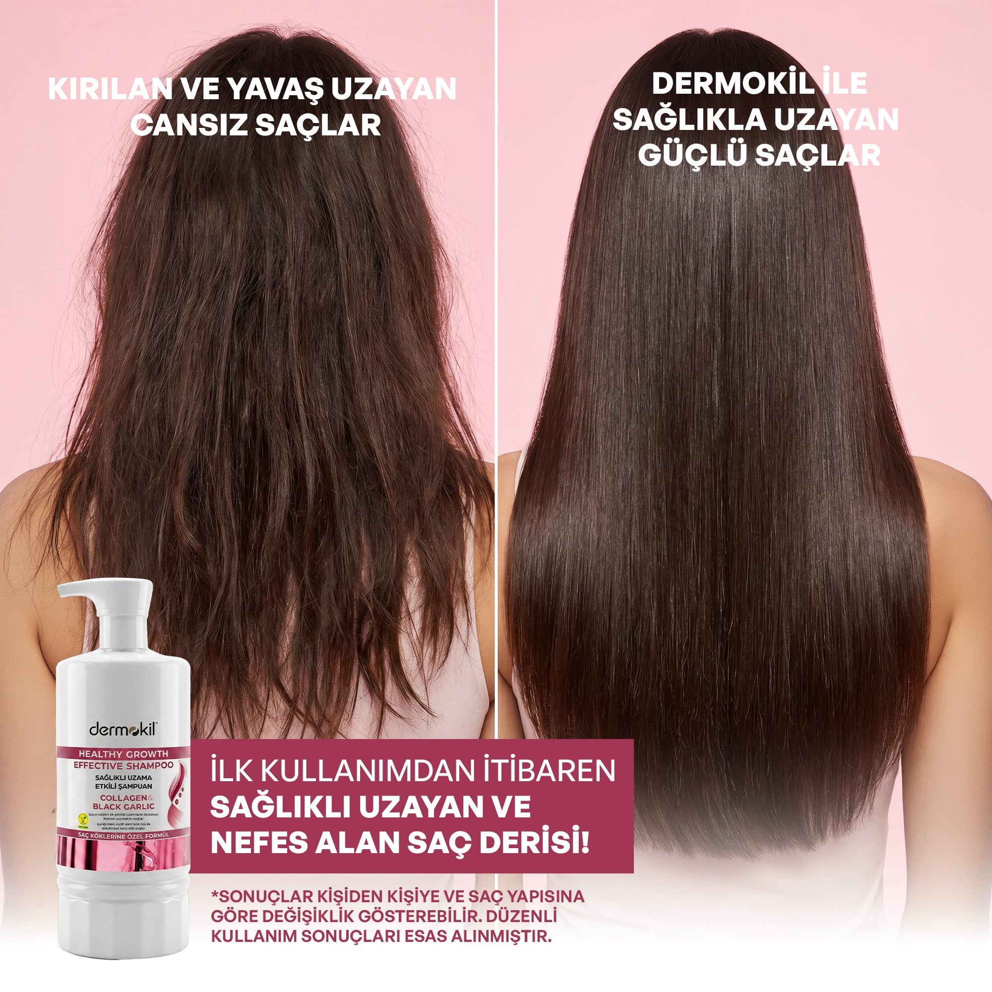 Kolajen & Siyah Sarımsak Sağlıklı Uzama Etkili Şampuan 950 ml - Dermokil