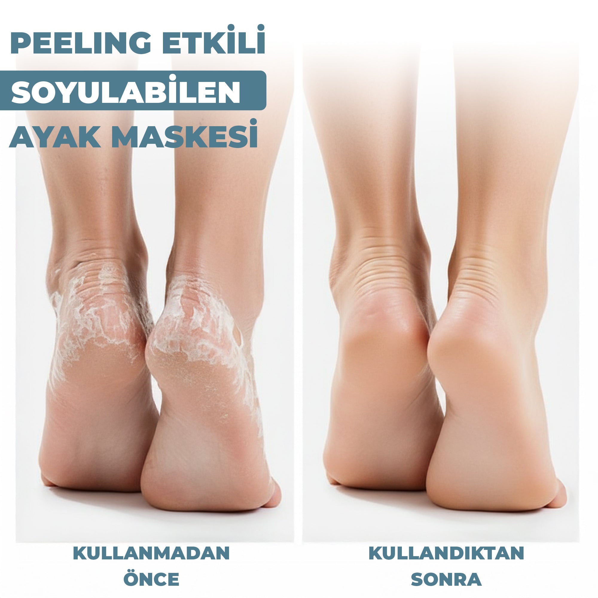 Peeling Etkili Soyulabilir Ayak Maskesi 30 ml - Dermokil