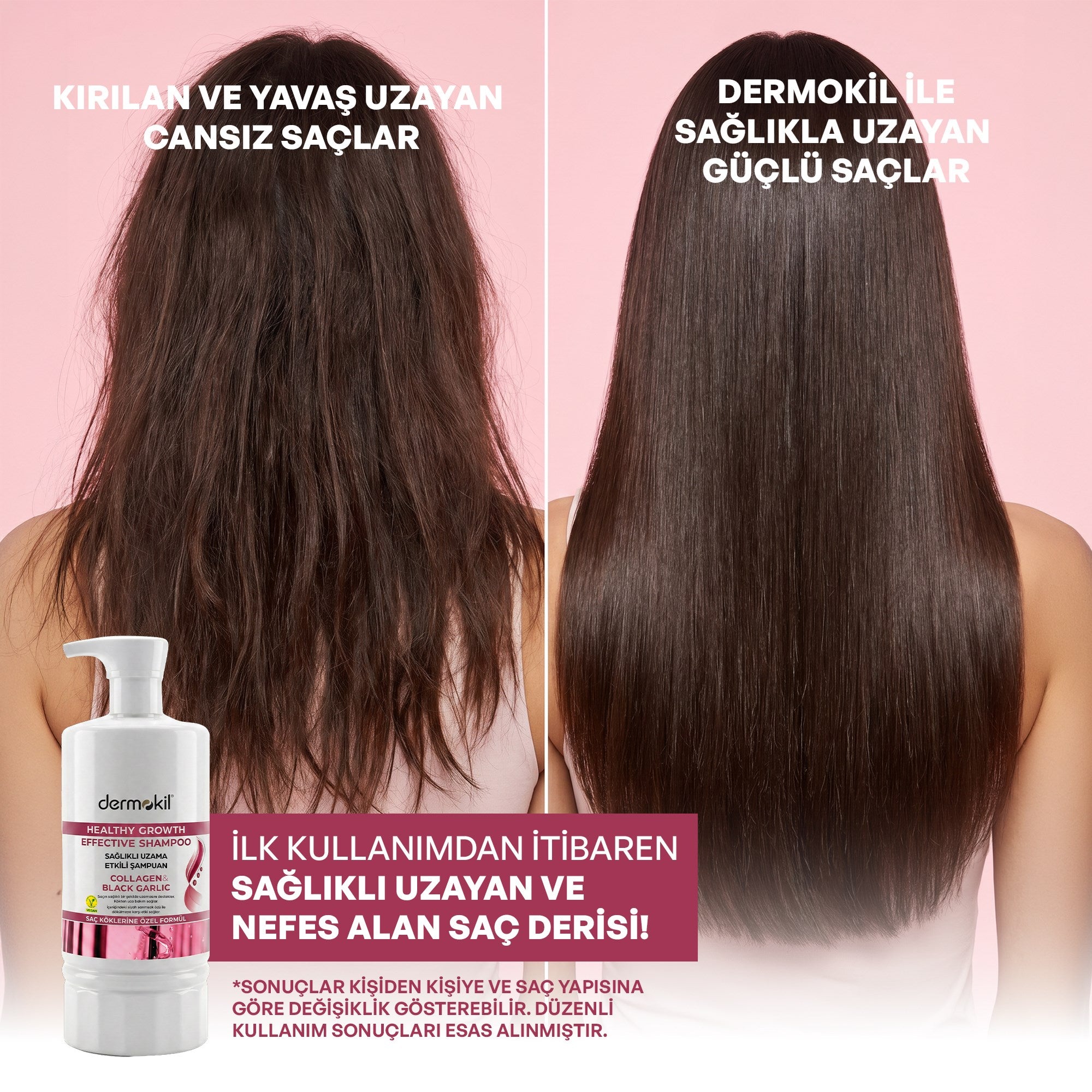 Sağlıklı Uzama Etkili Saç Bakım Seti - Dermokil